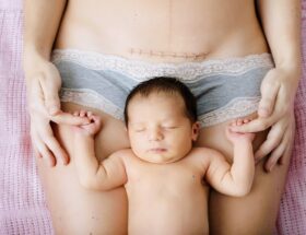 C-Section Recovery Tips to Heal Faster.