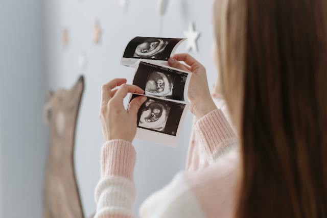 Fetal Development Milestones a Concise Guide.